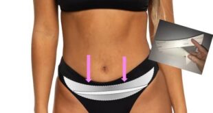 Discovering Skinnies 5: Our Instant Bikini Tummy Tuck Solution